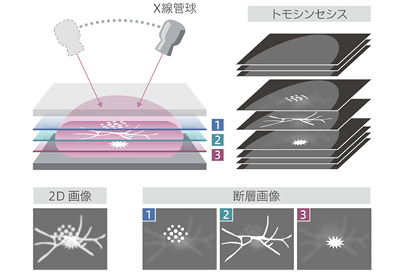鈴木クリニック　マンモグラフィ